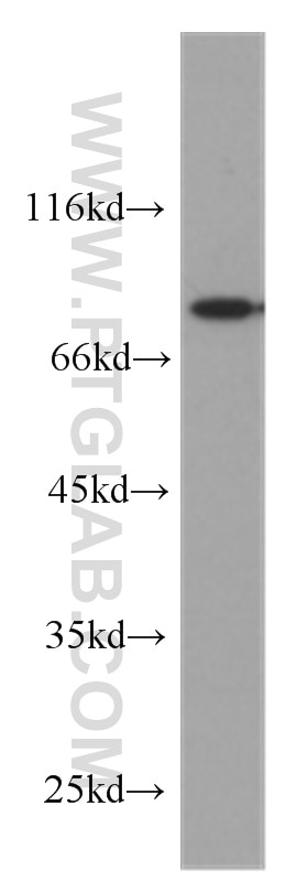 SH-SY5Y cells were subjected to SDS PAGE followed by western blot with 60204-1-Ig(DNAJB2 Antibody) at dilution of 1:1000 DNAJB2 western blot WB 60204-1-Ig DNAJB2 Antibody HSJ1; HSPF3
