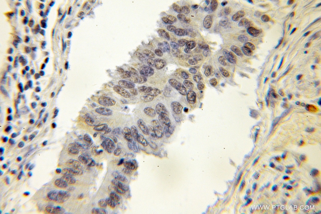 DNAJC1 IHC Immunohistochemical 12362-1-AP DNAJC1 Antibody DNAJL1; ERdj1; HTJ1; MGC131954; MTJ1