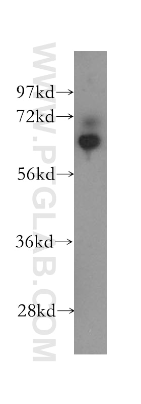 DNAJC1 western blot WB 12362-1-AP DNAJC1 Antibody DNAJL1; ERdj1; HTJ1; MGC131954; MTJ1