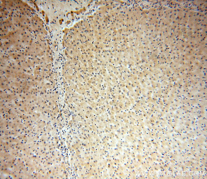 DNAJC15 IHC Immunohistochemical 16063-1-AP DNAJC15 Antibody DNAJD1; HSD18; MCJ