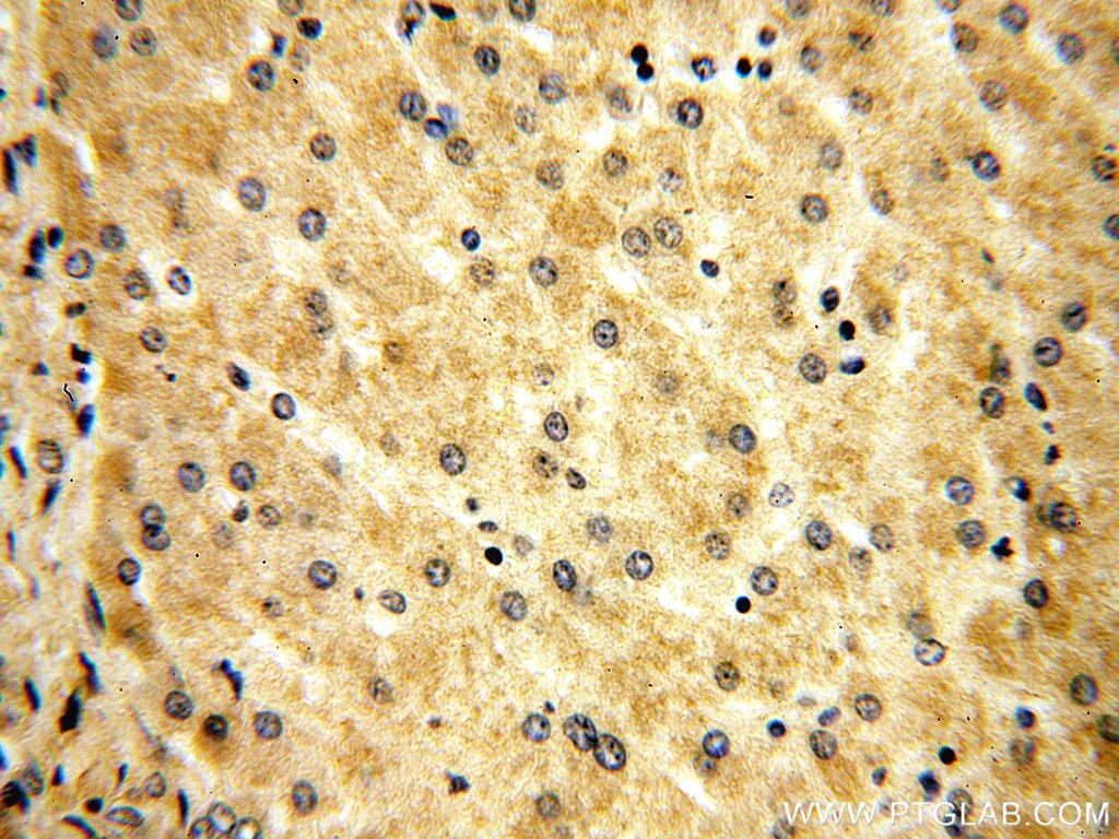 DNAJC15 IHC Immunohistochemical 16063-1-AP DNAJC15 Antibody DNAJD1; HSD18; MCJ