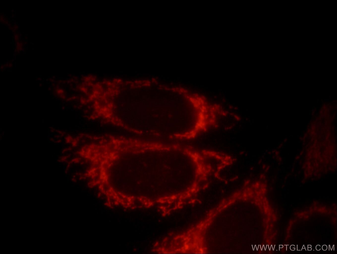 Immunofluorescent analysis of HepG2 cells, using DNAJC19 antibody 12096-1-AP at 1:25 dilution and Rhodamine-labeled goat anti-rabbit IgG (red). DNAJC19 Immunofluorescence IF 12096-1-AP DNAJC19 Antibody TIM14; TIMM14