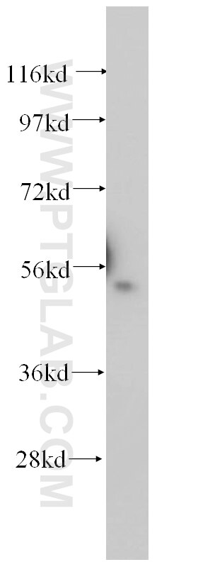 DNPEP western blot WB 15016-1-AP DNPEP Antibody ASPEP; DAP