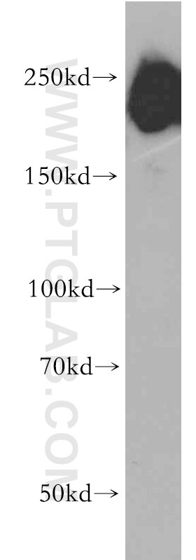 DOCK3; MOCA western blot WB 20683-1-AP DOCK3; MOCA Antibody KIAA0299; MOCA; PBP