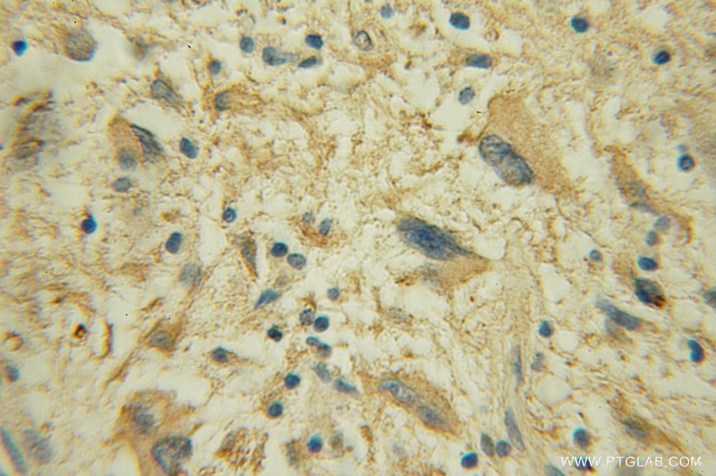 DPM1 IHC Immunohistochemical 12403-2-AP DPM1 Antibody CDGIE; MPDS