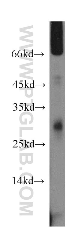 DPM1 western blot WB 12403-2-AP DPM1 Antibody CDGIE; MPDS