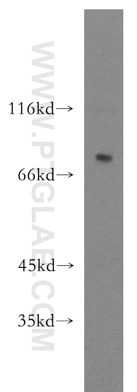 PC-3 cells were subjected to SDS PAGE followed by western blot with 12752-1-AP(DPP8 Antibody) at dilution of 1:500 DPP8 western blot WB 12752-1-AP DPP8 Antibody DP8; DPRP1; FLJ14920; FLJ20283; MGC26191; MSTP141