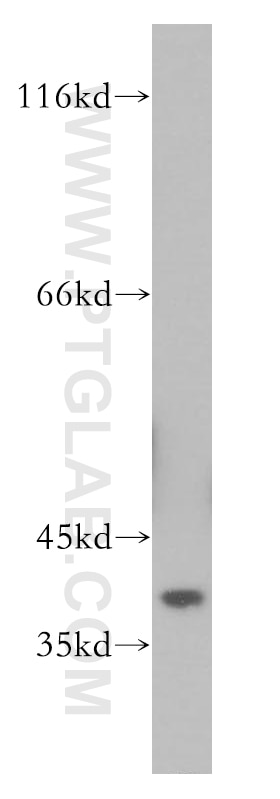 A431 cells were subjected to SDS PAGE followed by western blot with 10204-2-AP(DUSP11 Antibody) at dilution of 1:600 DUSP11 western blot WB 10204-2-AP DUSP11 Antibody PIR1