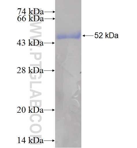 DUSP15 fusion protein ag6204 SDS-PAGE