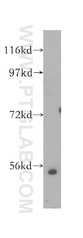 HeLa cells were subjected to SDS PAGE followed by western blot with 12171-1-AP(E2F1 Antibody) at dilution of 1:800 E2F1 western blot WB 12171-1-AP E2F1 Antibody E2F-1; RBAP1; RBBP3; RBP3