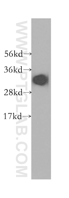HeLa cells were subjected to SDS PAGE followed by western blot with 12255-1-AP(EBAG9 Antibody) at dilution of 1:1000 EBAG9 western blot WB 12255-1-AP EBAG9 Antibody EB9; PDAF; RCAS1