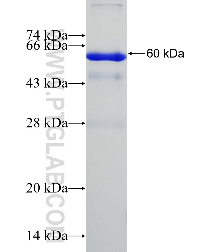 EBAG9 fusion protein ag2905 SDS-PAGE