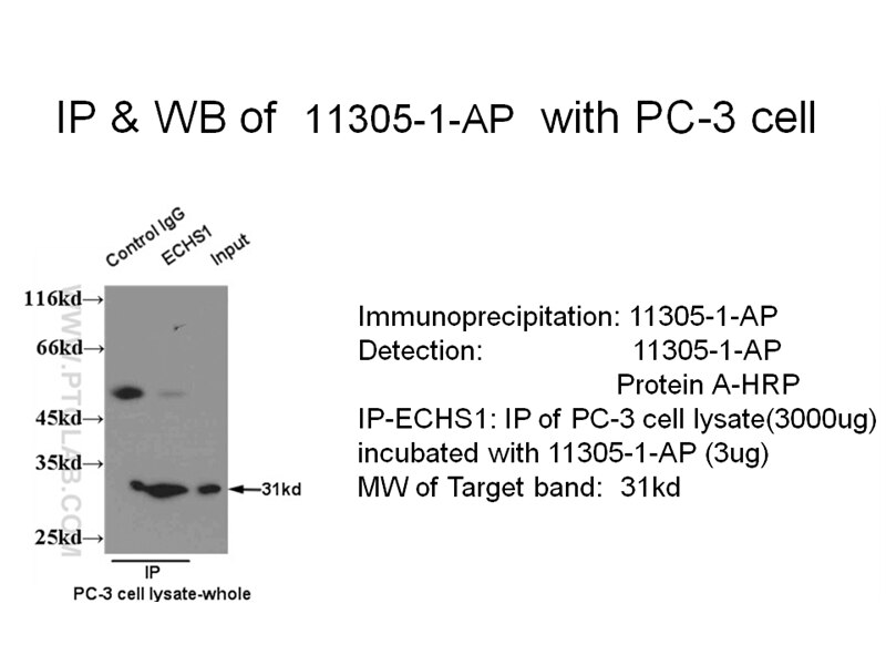 ECHS1 IP 11305-1-AP ECHS1 Antibody SCEH