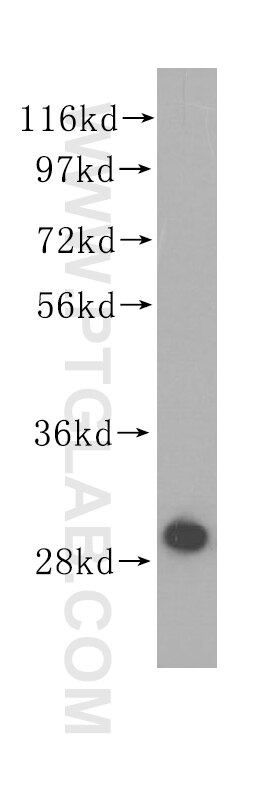 ECHS1 western blot WB 11305-1-AP ECHS1 Antibody SCEH