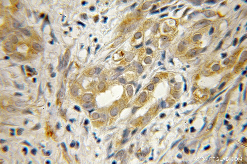 EEF1B2 IHC Immunohistochemical 10095-2-AP EEF1B2 Antibody EEF1B; EEF1B1; EF1B