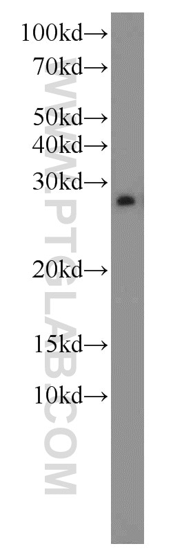 EEF1B2 western blot WB 10095-2-AP EEF1B2 Antibody EEF1B; EEF1B1; EF1B