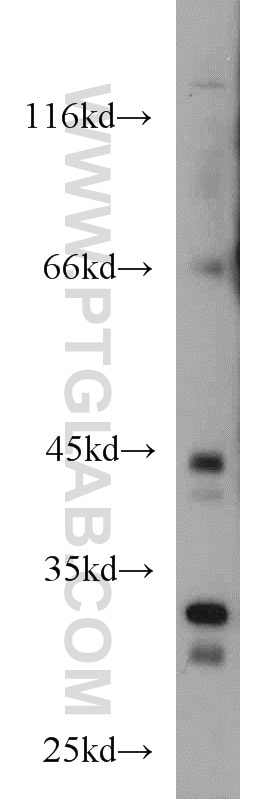 EGFL7 western blot WB 19291-1-AP EGFL7 Antibody MGC111117; RP11-251M1.2; VE-STATIN; ZNEU1