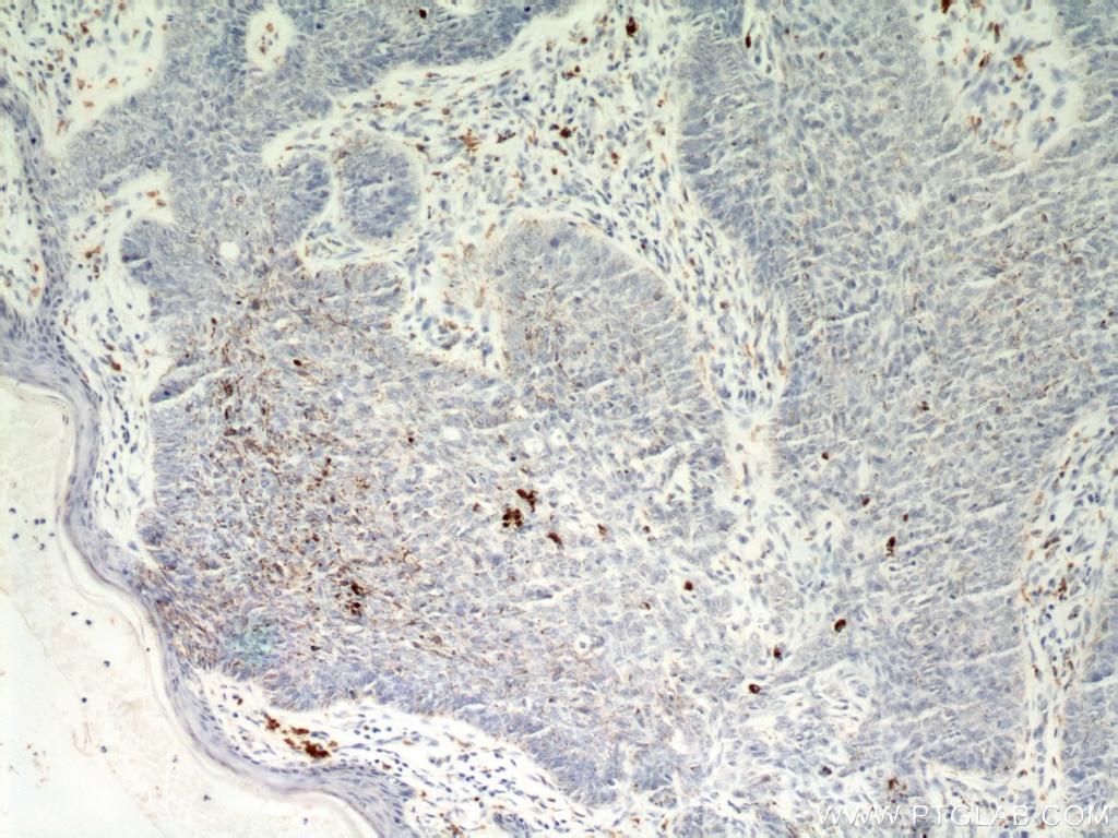 egfr antibody