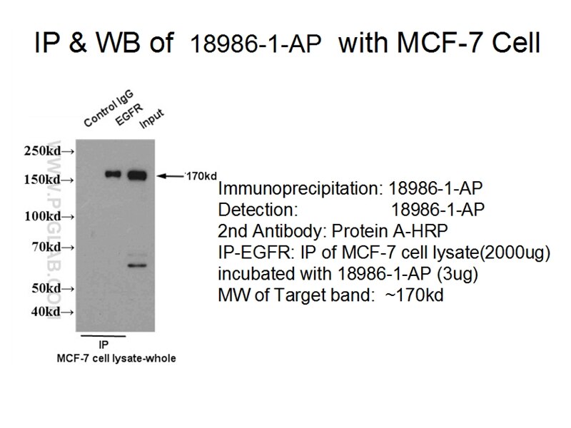 EGFR-Specific IP 18986-1-AP EGFR-Specific Antibody ERBB; ERBB1; HER1; PIG61; mENA