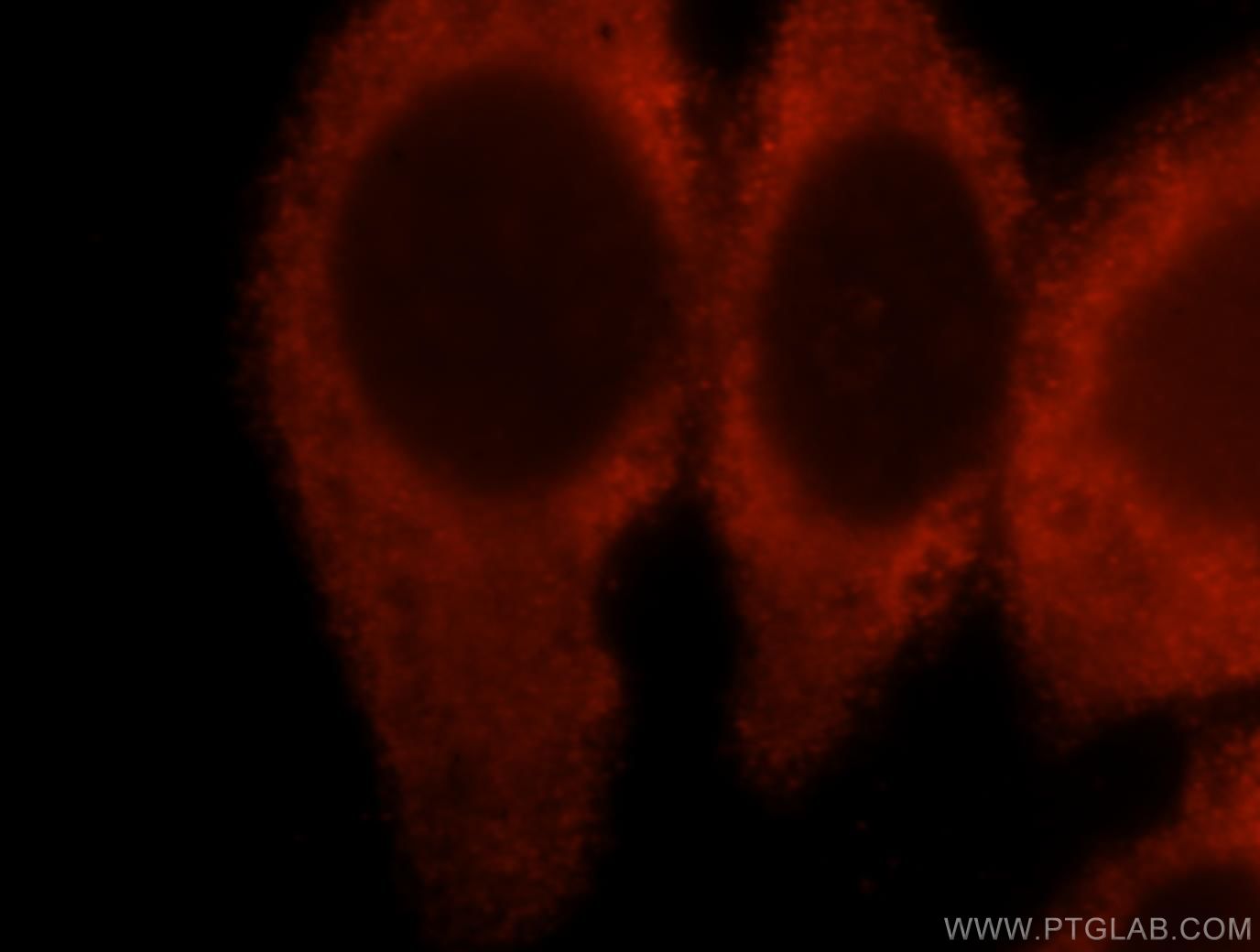 EGFR-Specific Immunofluorescence IF 18986-1-AP EGFR-Specific Antibody ERBB; ERBB1; HER1; PIG61; mENA