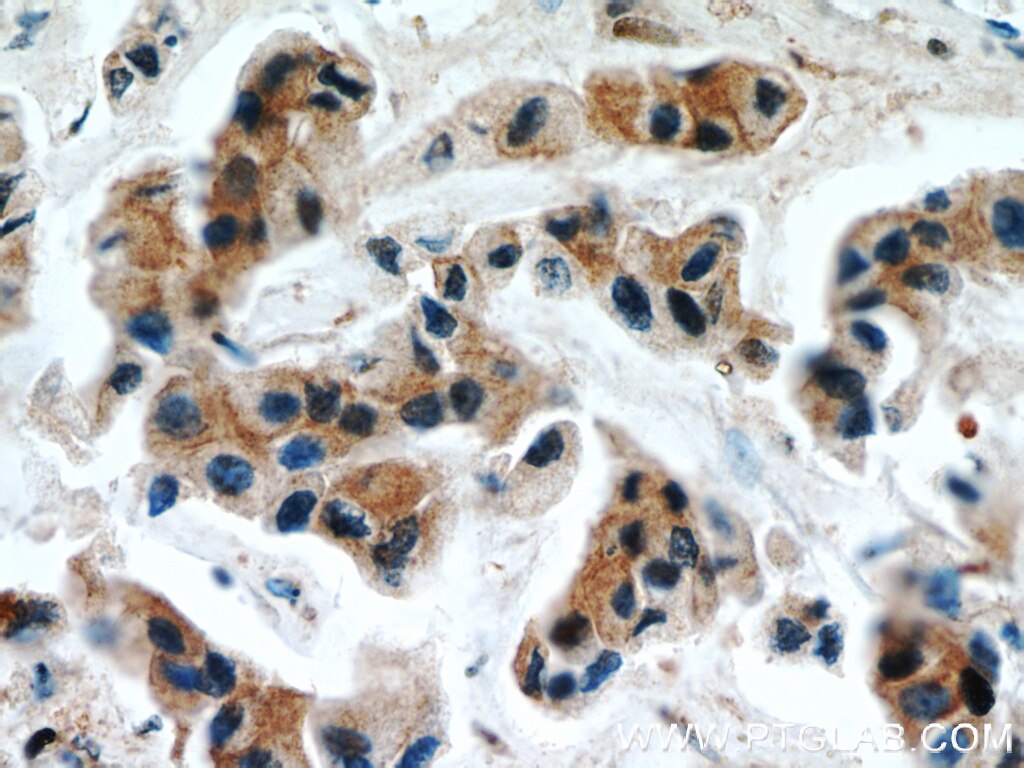 Egfr Ihc