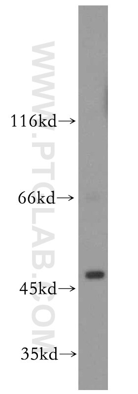 EGLN1 western blot WB 19886-1-AP EGLN1 Antibody C1orf12; DKFZp761F179; ECYT3; HIFPH2; HPH2; PHD2; SM-20; SM20; ZMYND6