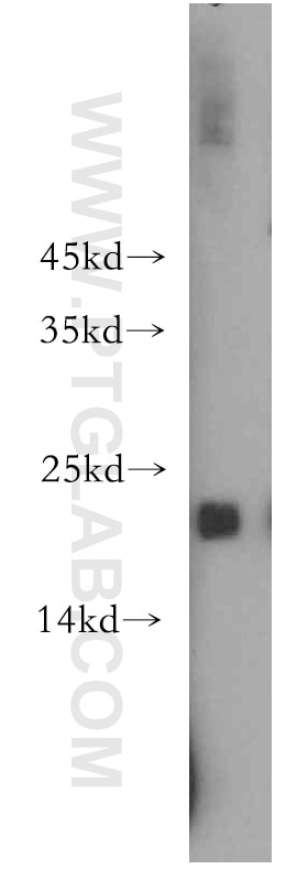 HepG2 cells were subjected to SDS PAGE followed by western blot with 11734-1-AP(EID1 Antibody) at dilution of 1:1000 EID1 western blot WB 11734-1-AP EID1 Antibody C15orf3; CRI1; EID-1; IRO45620; MGC138883; MGC138884; PNAS-22; PTD014; RBP21