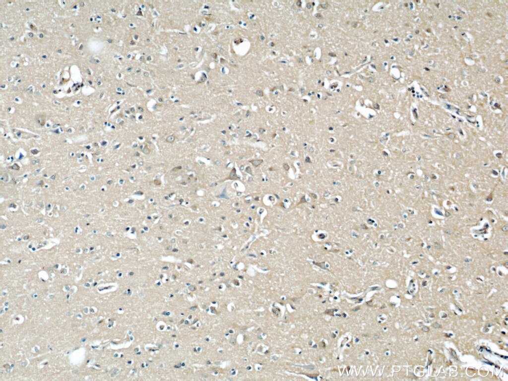 EIF3D IHC Immunohistochemical 66024-1-Ig EIF3D Antibody EIF3S7; MGC126526; MGC17258; eIF3-p66; eIF3-zeta