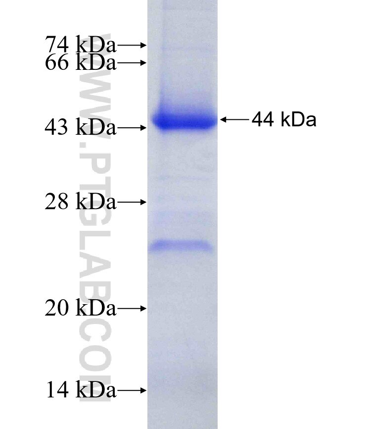 EIF3M fusion protein ag17965 SDS-PAGE