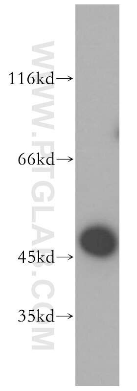 HEK-293 cells were subjected to SDS PAGE followed by western blot with 10463-1-AP(EIF4A3 Antibody) at dilution of 1:300 EIF4A3 western blot WB 10463-1-AP EIF4A3 Antibody DDX48; KIAA0111; MGC10862; NMP265; NUK-34; eIF4AIII; hNMP265