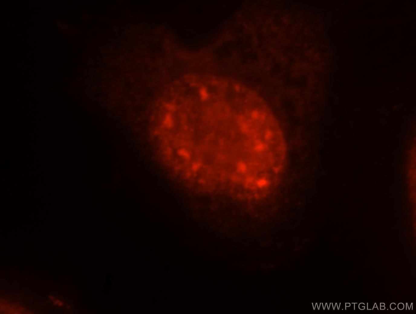 EIF4A3 Immunofluorescence IF 17504-1-AP EIF4A3 Antibody DDX48; KIAA0111; MGC10862; NMP265; NUK-34; eIF4AIII; hNMP265
