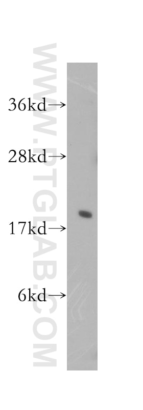 HeLa cells were subjected to SDS PAGE followed by western blot with 11309-1-AP(EIF5A Antibody) at dilution of 1:800 EIF5A western blot WB 11309-1-AP EIF5A Antibody EIF-5A; EIF5A1; MGC104255; MGC99547; eIF5AI