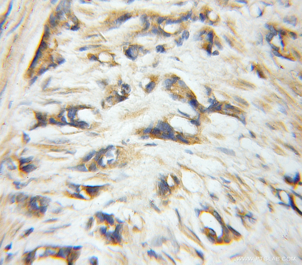 EIF6 IHC Immunohistochemical 10291-1-AP EIF6 Antibody 2; CAB; EIF3A; ITGB4BP; b; b(2)gcn; gcn; p27BBP