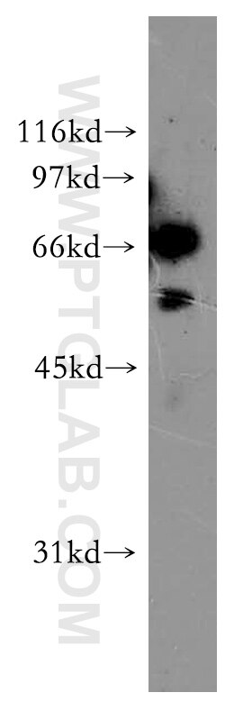 A2780 cells were subjected to SDS PAGE followed by western blot with 12499-1-AP(ELF2 Antibody) at dilution of 1:1000 ELF2 western blot WB 12499-1-AP ELF2 Antibody EU32; NERF; NERF-1A; NERF-1B; NERF-1a,b; NERF-2