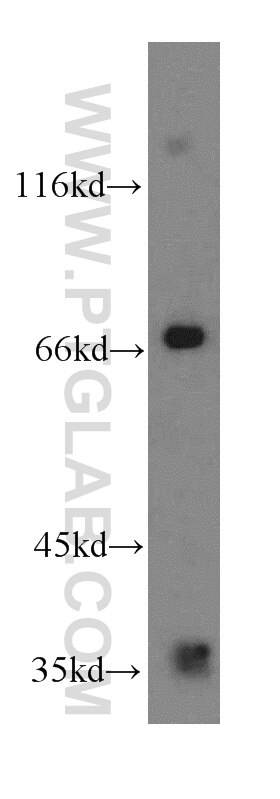 mouse brain tissue were subjected to SDS PAGE followed by western blot with 12727-1-AP(ELL2 Antibody) at dilution of 1:800 ELL2 western blot WB 12727-1-AP ELL2 Antibody