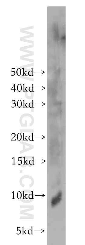 Jurkat cells were subjected to SDS PAGE followed by western blot with 21070-1-AP(ELOF1 Antibody) at dilution of 1:600 ELOF1 western blot WB 21070-1-AP ELOF1 Antibody ELF1
