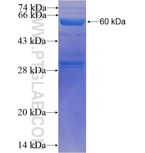 ENPP1 fusion protein ag5117 SDS-PAGE