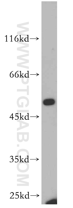 EPCAM western blot WB 21050-1-AP EPCAM Antibody CO-17A; CO17-1A; EGP; EGP-2; EGP34; EGP40; ESA; Ep-CAM; GA733-2; KS1/4; KSA; M4S1; MIC18; MK-1; TACST-1; TACSTD1; TROP1; hEGP-2