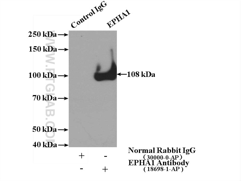 EPHA1-special-Antibody-18698-1-AP-IP-58073.jpg