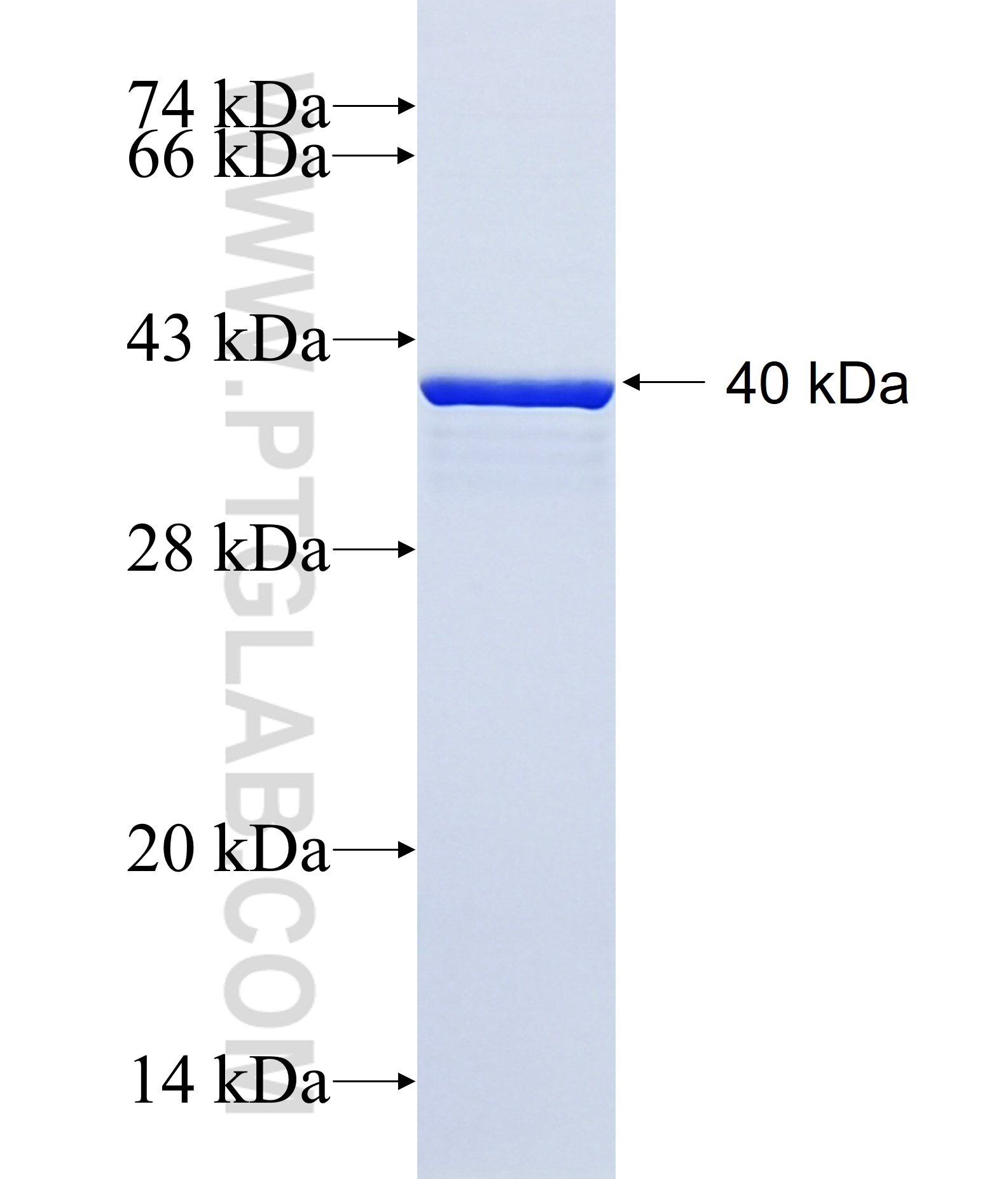 ER81 fusion protein ag16172 SDS-PAGE