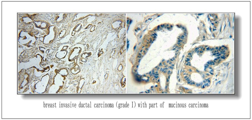 ERBB2 IHC 51105-1-AP ERBB2 Antibody CD340; HER-2; HER-2/neu; HER2; NEU; NGL; TKR1
