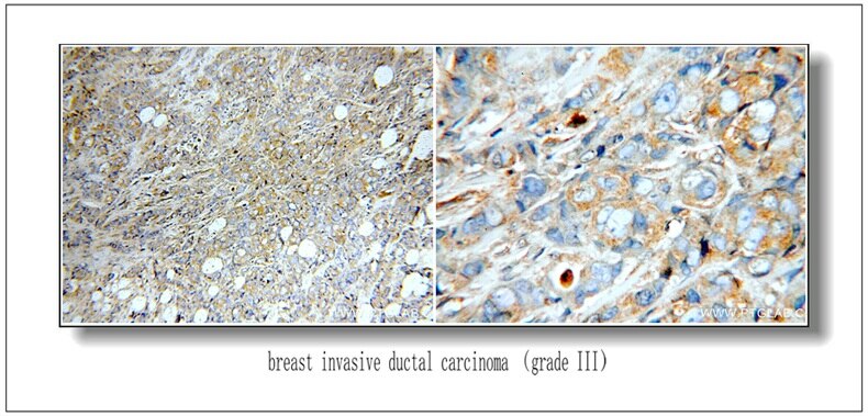 ERBB2 IHC 51105-1-AP ERBB2 Antibody CD340; HER-2; HER-2/neu; HER2; NEU; NGL; TKR1