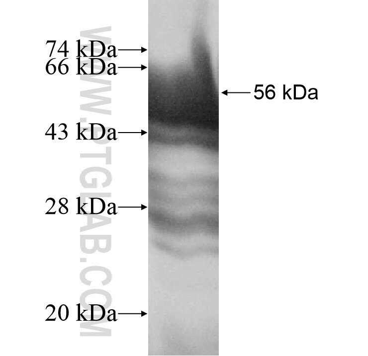 ERP27 fusion protein ag11063 SDS-PAGE
