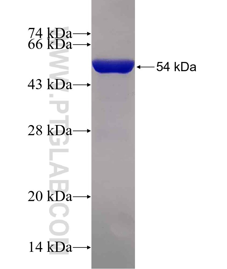 ETFB fusion protein ag12344 SDS-PAGE
