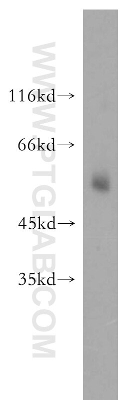 ETV4 western blot WB