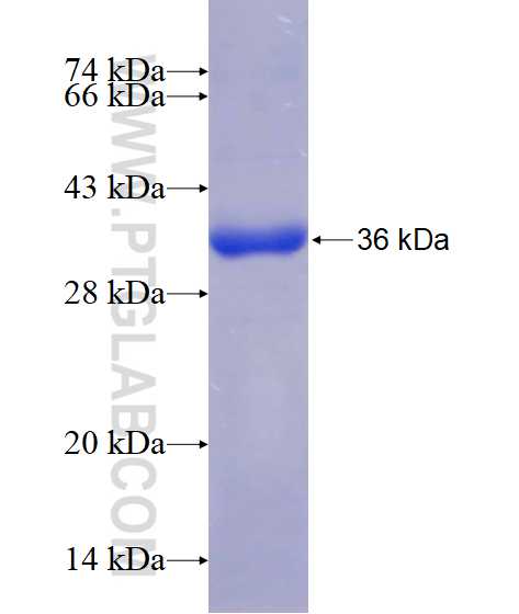 EXOSC8 fusion protein ag17516 SDS-PAGE