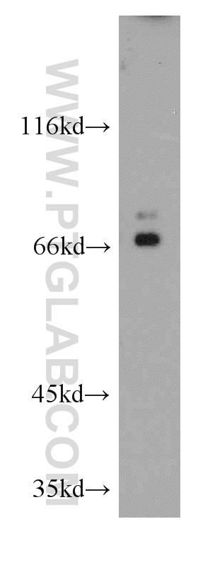 RAW 264.7 cells were subjected to SDS PAGE followed by western blot with 20852-1-AP(EZH1 Antibody) at dilution of 1:300 EZH1 western blot WB 20852-1-AP EZH1 Antibody KIAA0388
