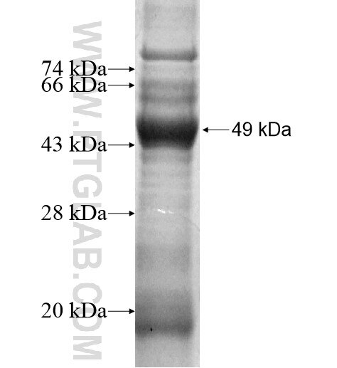 F8 fusion protein ag15582 SDS-PAGE