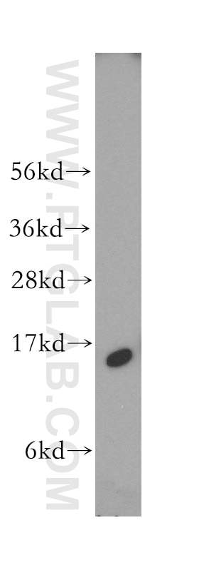 human brain tissue were subjected to SDS PAGE followed by western blot with 12348-1-AP(FABP5 Antibody) at dilution of 1:800 FABP5 western blot WB 12348-1-AP FABP5 Antibody E-FABP; EFABP; PA-FABP; PAFABP