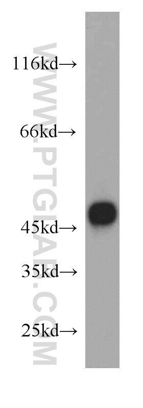 L02 cells were subjected to SDS PAGE followed by western blot with 15205-1-AP(FADS3 Antibody) at dilution of 1:1200 FADS3 western blot WB 15205-1-AP FADS3 Antibody CYB5RP; LLCDL3